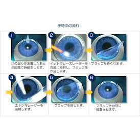 レーシックって医療保険で対応できますか？の問い合わせがよくあります。